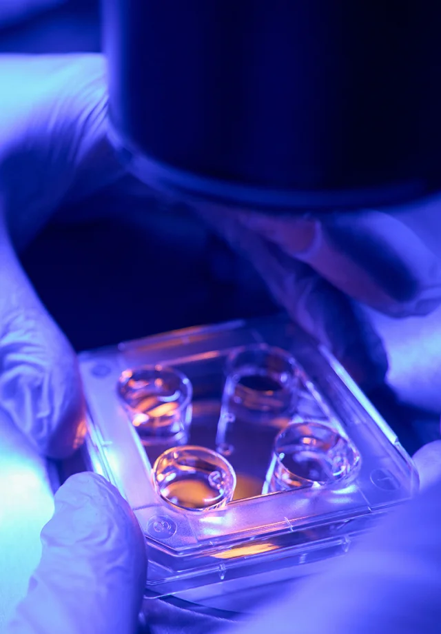 Ivf Treatment On Emi